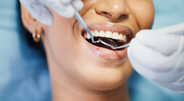 Best Emergency Broken Tooth Repair in Seaman, OH