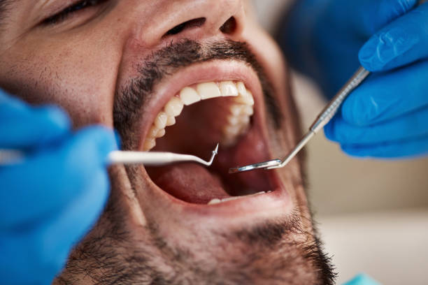 Best Walk-In Emergency Dentist in Seaman, OH